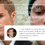 What is Ramsay Hunt Syndrome? Justin Bieber's Disease