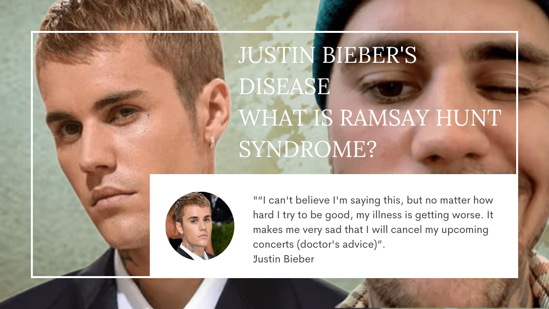 What is Ramsay Hunt Syndrome? Justin Bieber's Disease