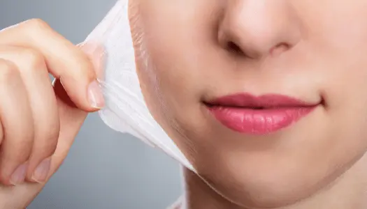 Chemical Peels Are Effective In The Peeling Skin Treatment