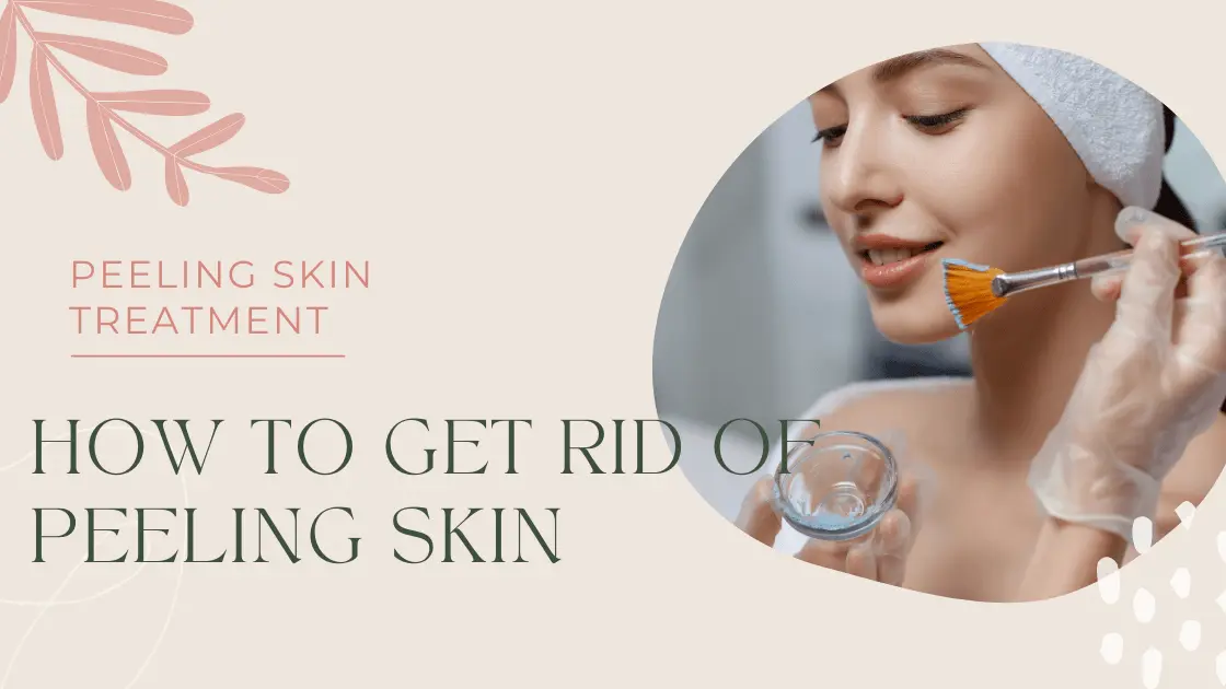Peeling Skin Treatment - Learn How To Get Rid Of Peeling Skin With Easy Ways