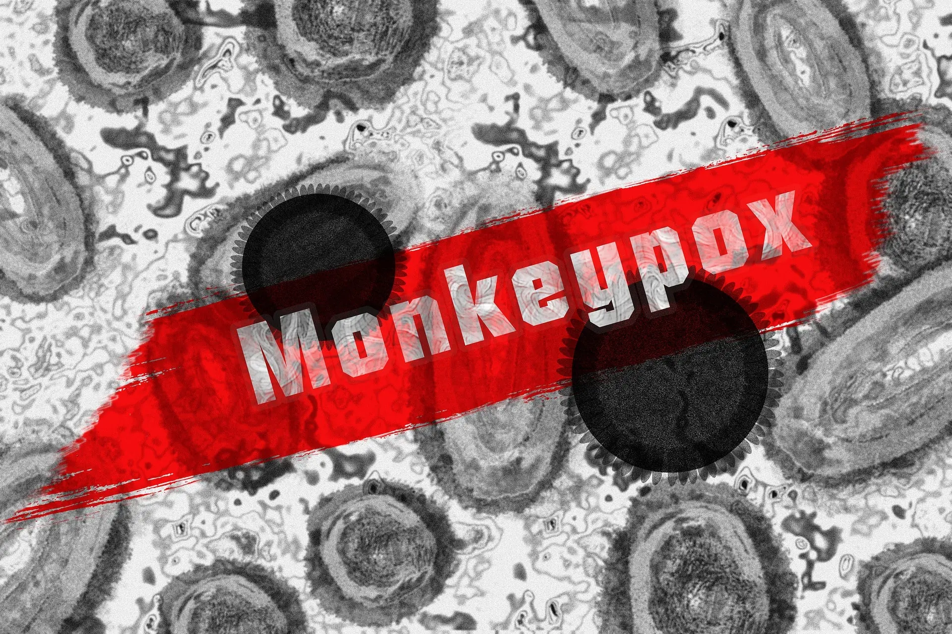 The Best-Known Effects of Monkeypox